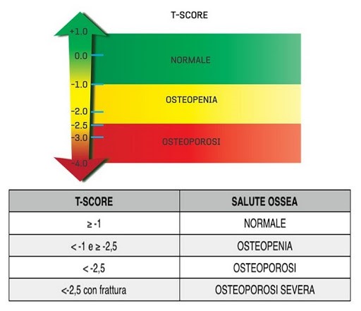 osteoporosi e osteopenia